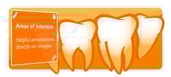 How to Add An Area Of Interest To A Dental Image