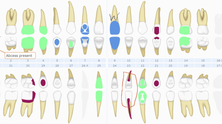 Curve Dental charting 