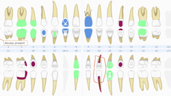 Curve Dental charting