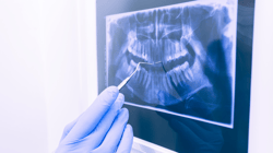dental x-ray