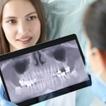 X-rays-SQ copy