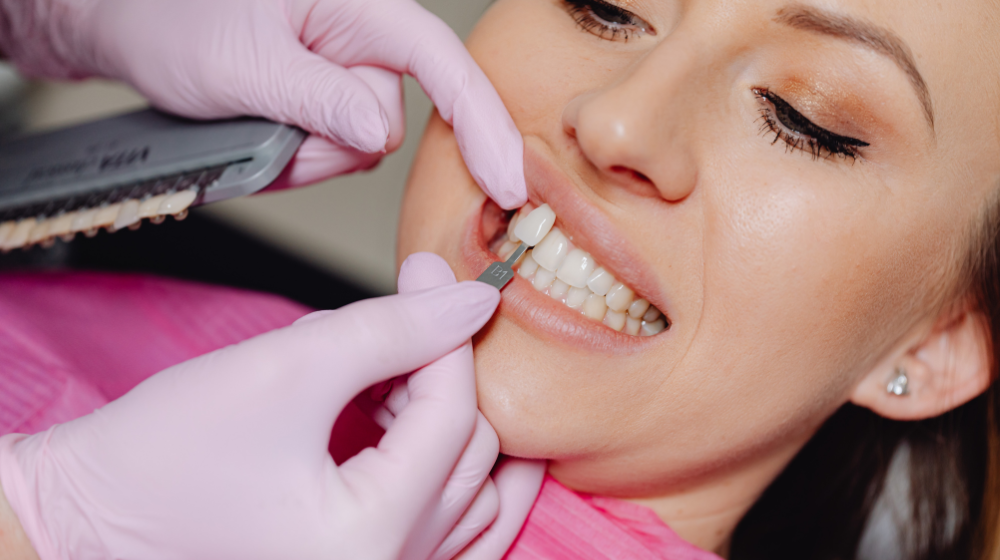 Dentist matching a veneer shade guide to a patient’s teeth during a cosmetic dental consultation.