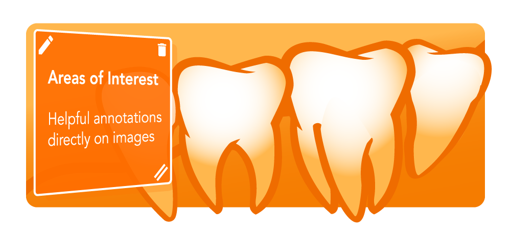 How to Add An Area Of Interest To A Dental Image