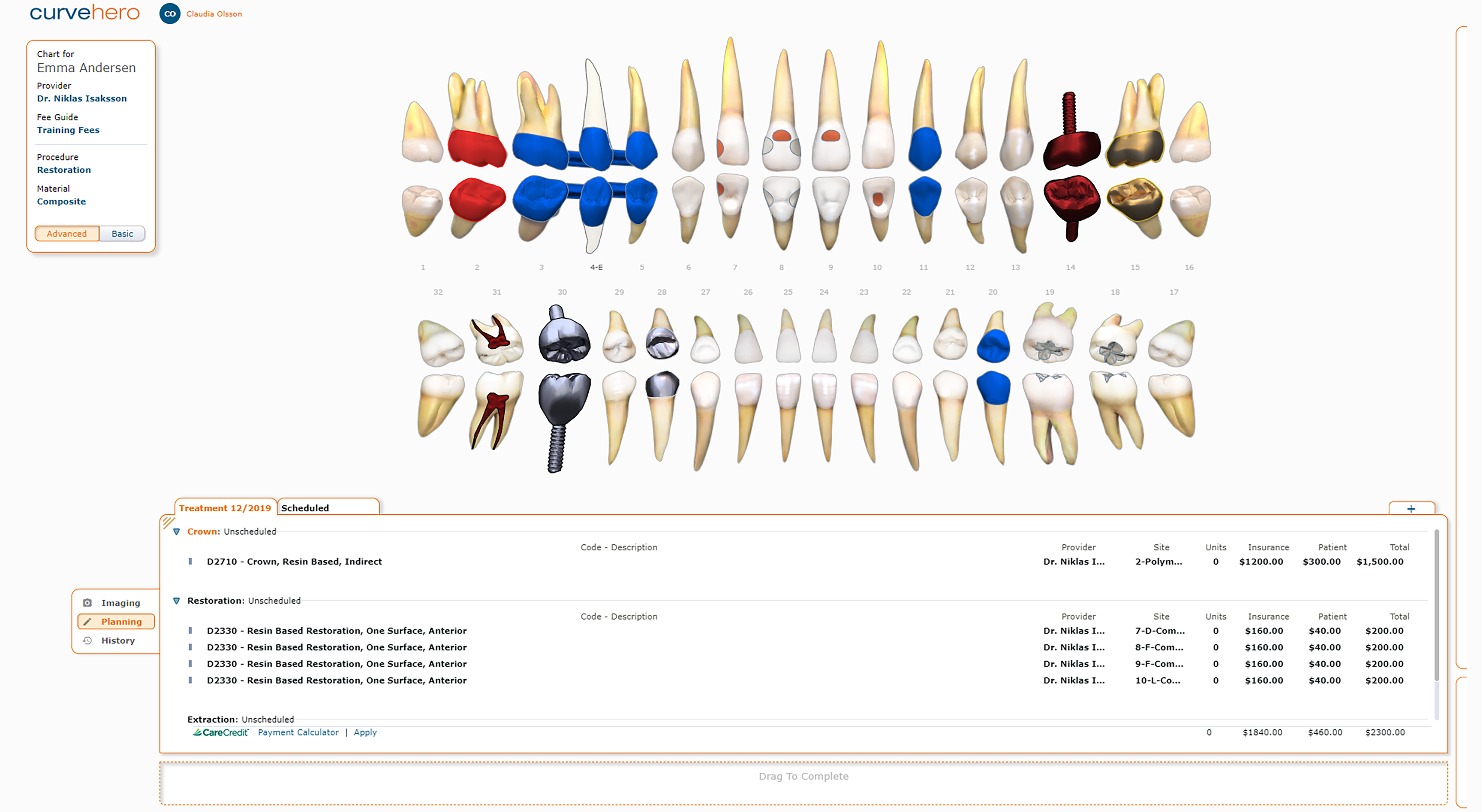 Curve Dental Charting