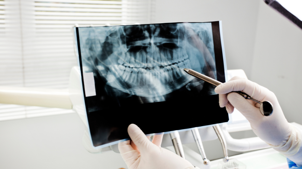dental x-ray