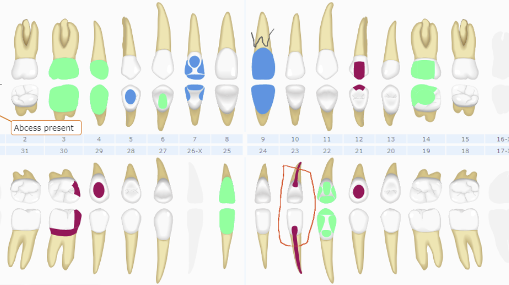 Curve Dental charting