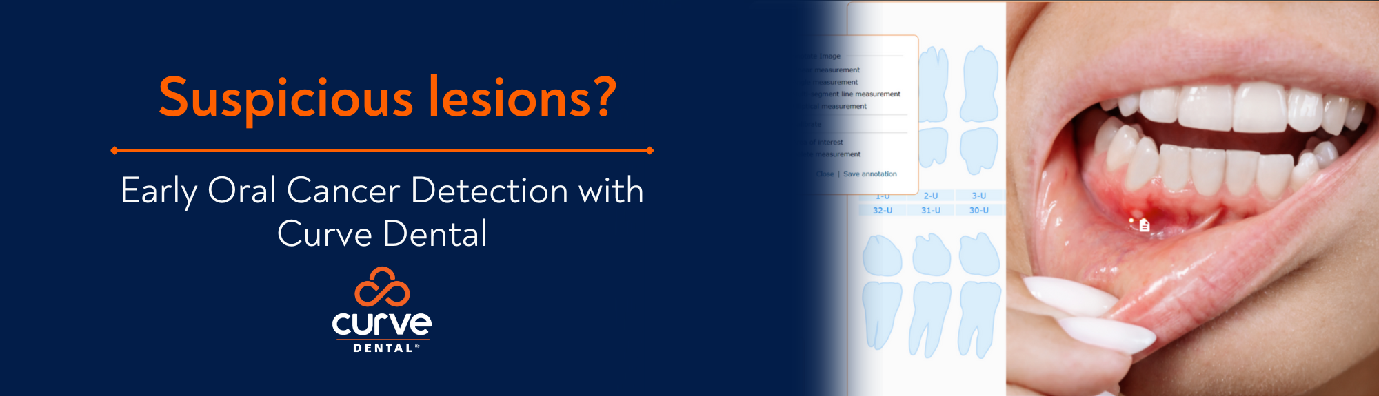 Suspicious Lesions? Early Oral Cancer Detection with Curve Dental