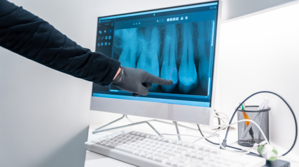 dental professional pointing to digital perio chart
