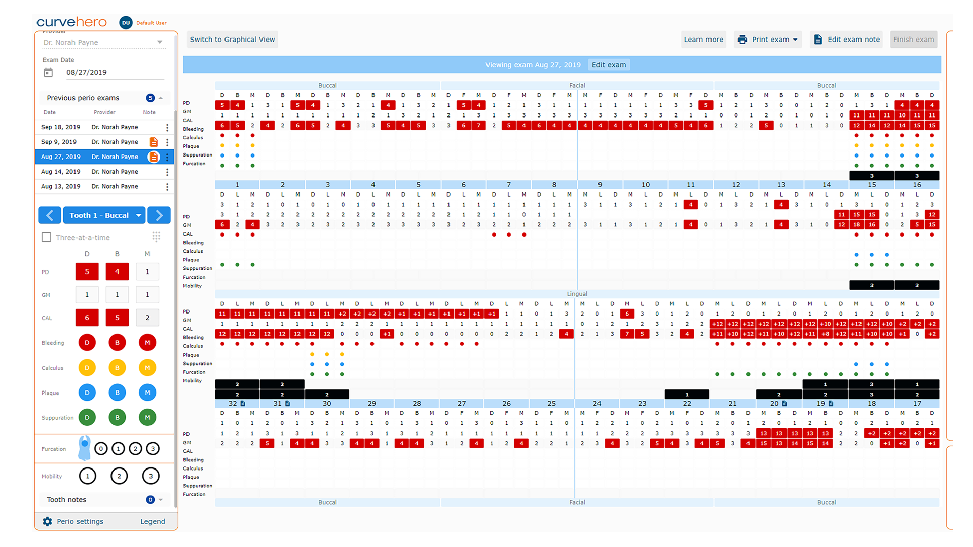 Perio Charting Dental